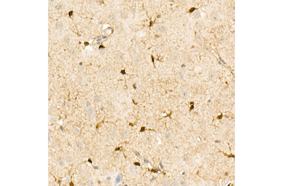 Immunohistochemistry - Anti-S100A1 Antibody (A329822) - Antibodies.com