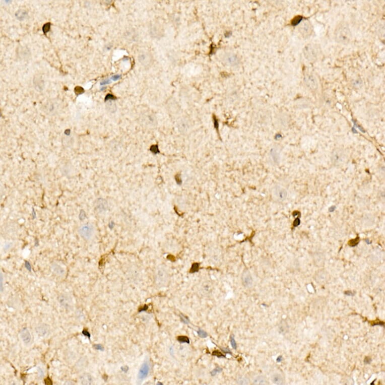 Immunohistochemistry - Anti-S100A1 Antibody (A329822) - Antibodies.com