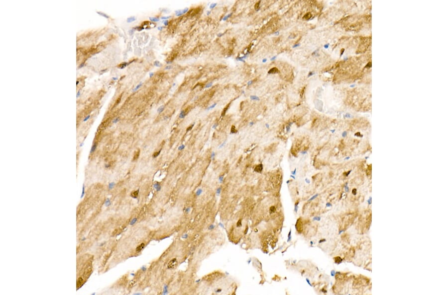 Immunohistochemistry - Anti-S100A1 Antibody (A329822) - Antibodies.com