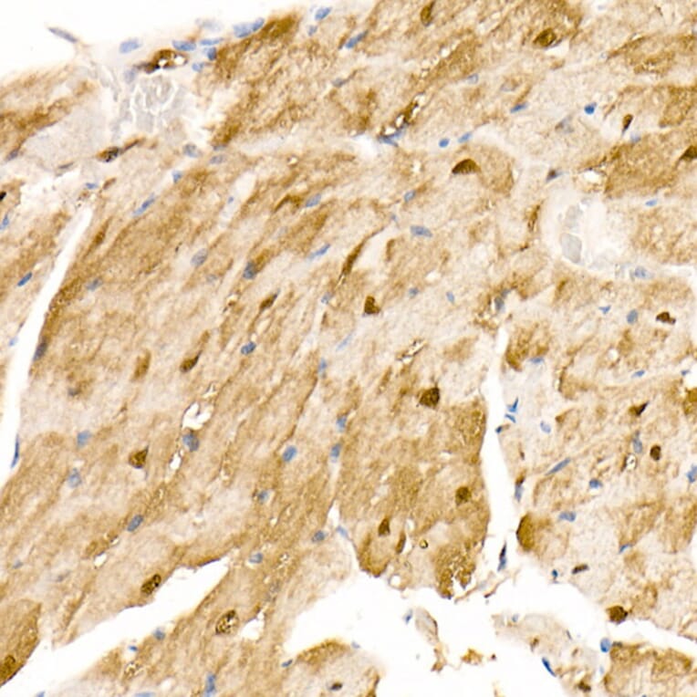 Immunohistochemistry - Anti-S100A1 Antibody (A329822) - Antibodies.com