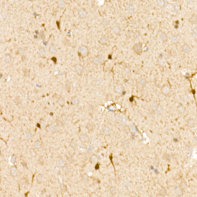 Immunohistochemistry - Anti-S100A1 Antibody (A329822) - Antibodies.com