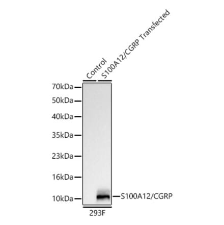 Western Blot - Anti-S100A12 Antibody [ARC61785] (A329825) - Antibodies.com