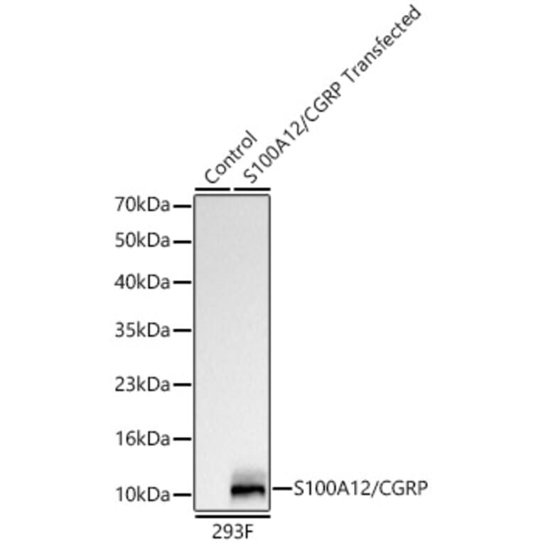 Western Blot - Anti-S100A12 Antibody [ARC61785] (A329825) - Antibodies.com