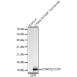 Western Blot - Anti-S100A12 Antibody [ARC61785] (A329825) - Antibodies.com
