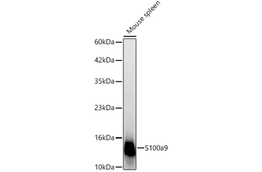Western Blot - Anti-S100A9 Antibody (A329826) - Antibodies.com