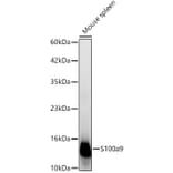 Western Blot - Anti-S100A9 Antibody (A329826) - Antibodies.com