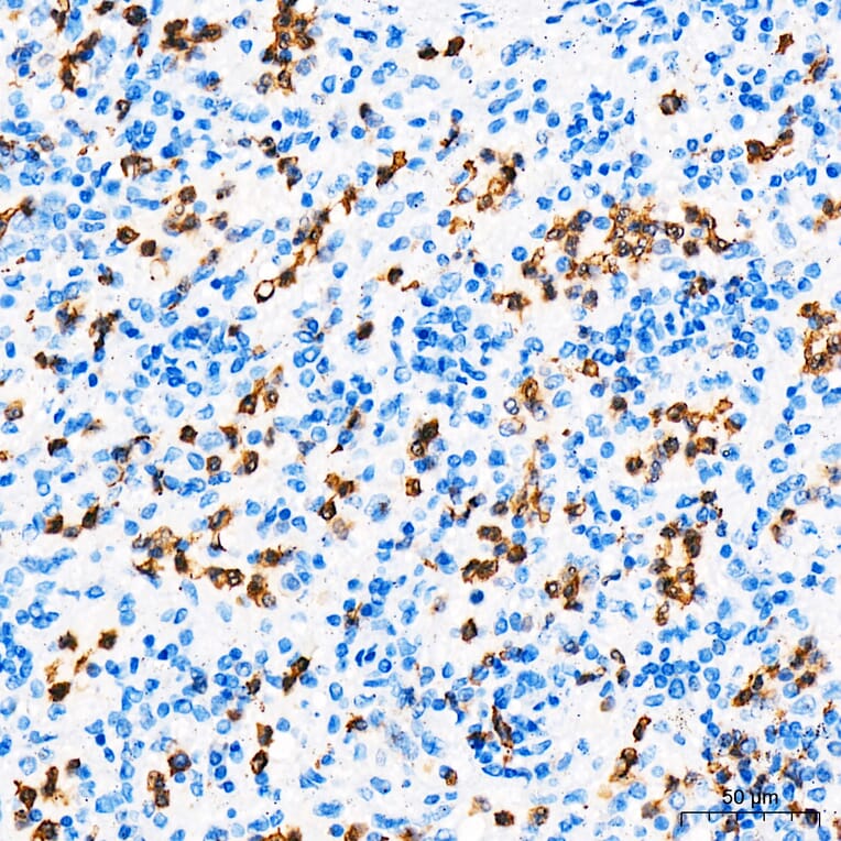 Immunohistochemistry - Anti-S100A9 Antibody (A329826) - Antibodies.com