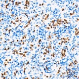 Immunohistochemistry - Anti-S100A9 Antibody (A329826) - Antibodies.com