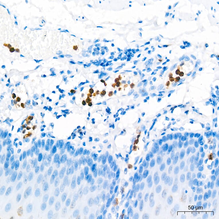 Immunohistochemistry - Anti-S100A9 Antibody (A329826) - Antibodies.com