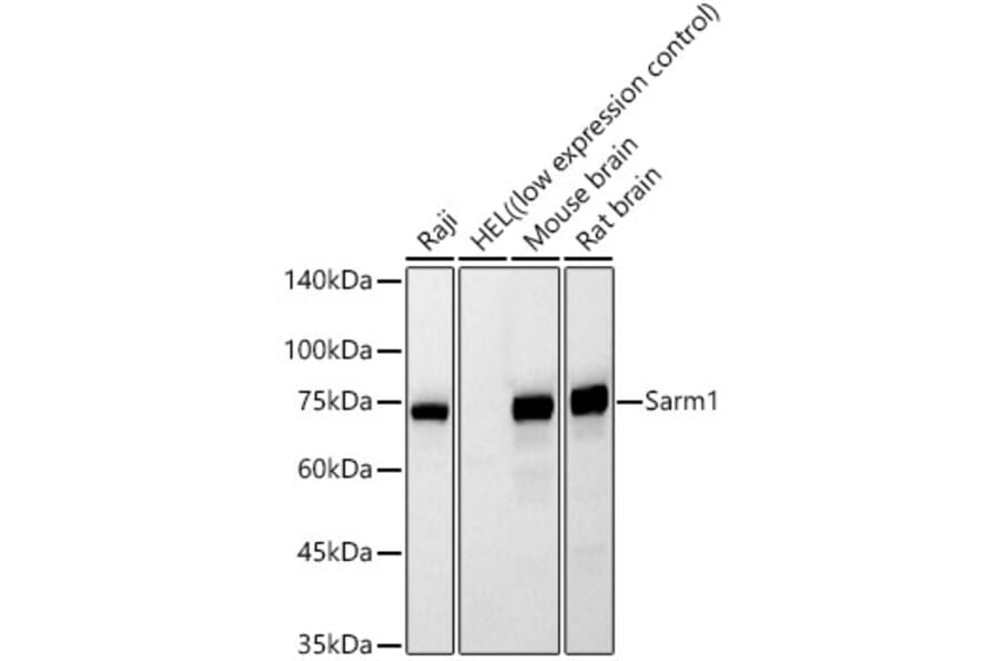 Western Blot - Anti-SARM1 Antibody [AMC0559] (A329827) - Antibodies.com