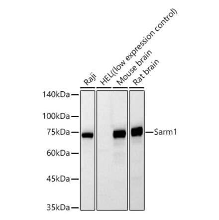 Western Blot - Anti-SARM1 Antibody [AMC0559] (A329827) - Antibodies.com