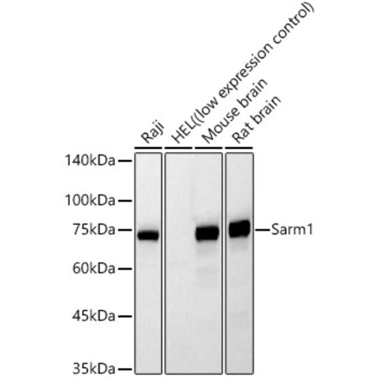 Western Blot - Anti-SARM1 Antibody [AMC0559] (A329827) - Antibodies.com