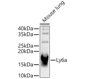 Western Blot - Anti-Sca1 Antibody (A329830) - Antibodies.com