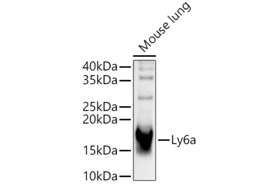 Western Blot - Anti-Sca1 Antibody (A329830) - Antibodies.com