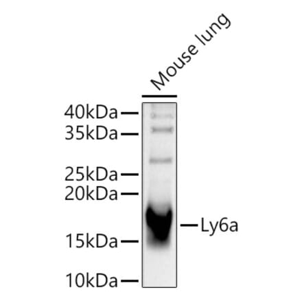 Western Blot - Anti-Sca1 Antibody (A329830) - Antibodies.com