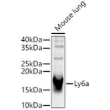 Western Blot - Anti-Sca1 Antibody (A329830) - Antibodies.com