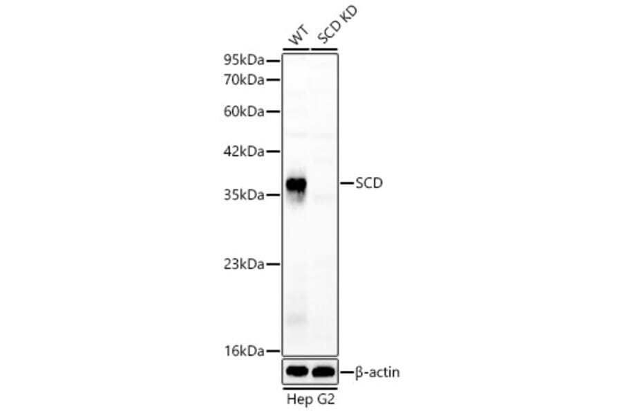 Western Blot - Anti-SCD1 Antibody (A329831) - Antibodies.com
