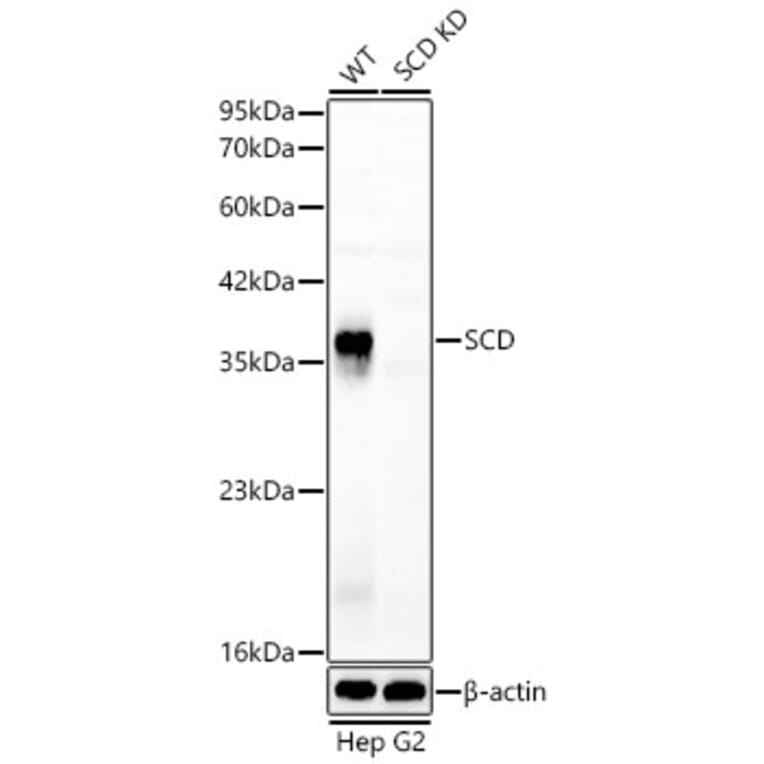 Western Blot - Anti-SCD1 Antibody (A329831) - Antibodies.com