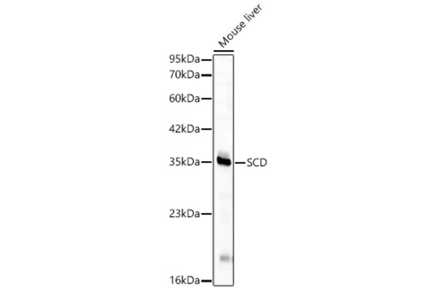 Western Blot - Anti-SCD1 Antibody (A329831) - Antibodies.com