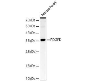 Western Blot - Anti-SCDGFB Antibody (A329832) - Antibodies.com