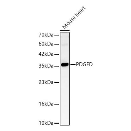 Western Blot - Anti-SCDGFB Antibody (A329832) - Antibodies.com