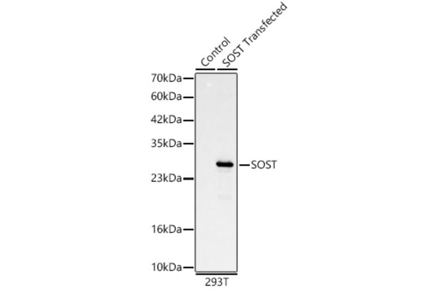 Western Blot - Anti-Sclerostin Antibody (A329833) - Antibodies.com