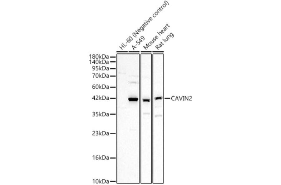 Western Blot - Anti-SDPR Antibody (A329834) - Antibodies.com