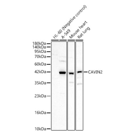 Western Blot - Anti-SDPR Antibody (A329834) - Antibodies.com