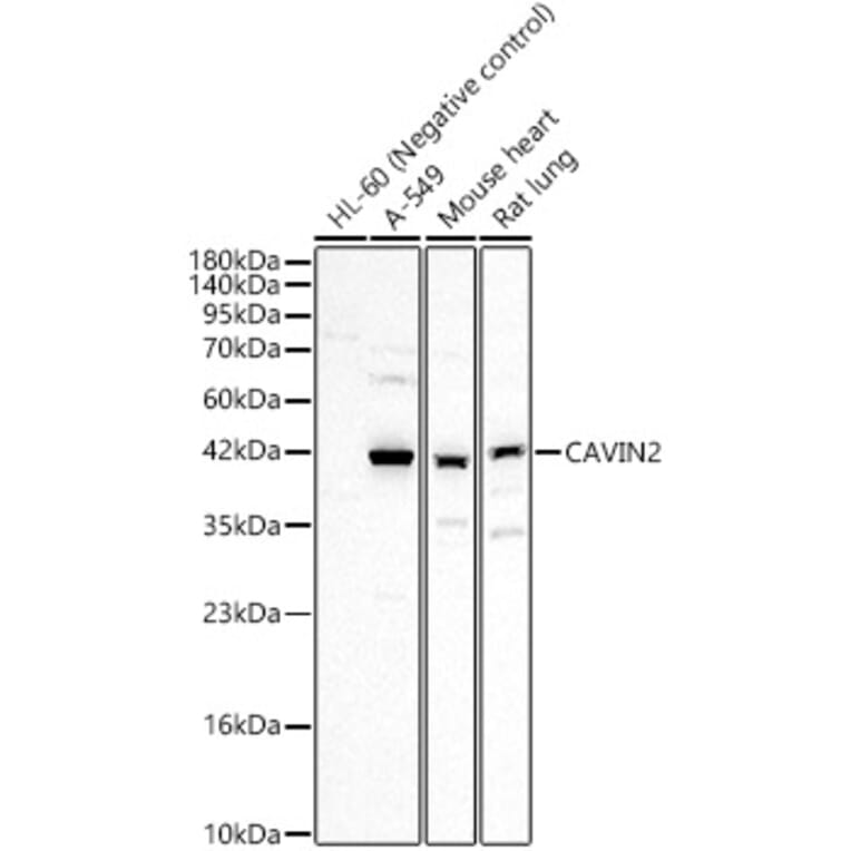 Western Blot - Anti-SDPR Antibody (A329834) - Antibodies.com