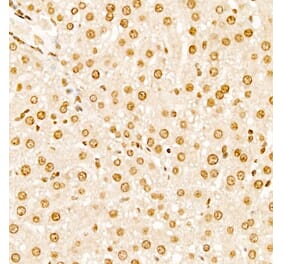 Immunohistochemistry - Anti-TAP Antibody (A329835) - Antibodies.com