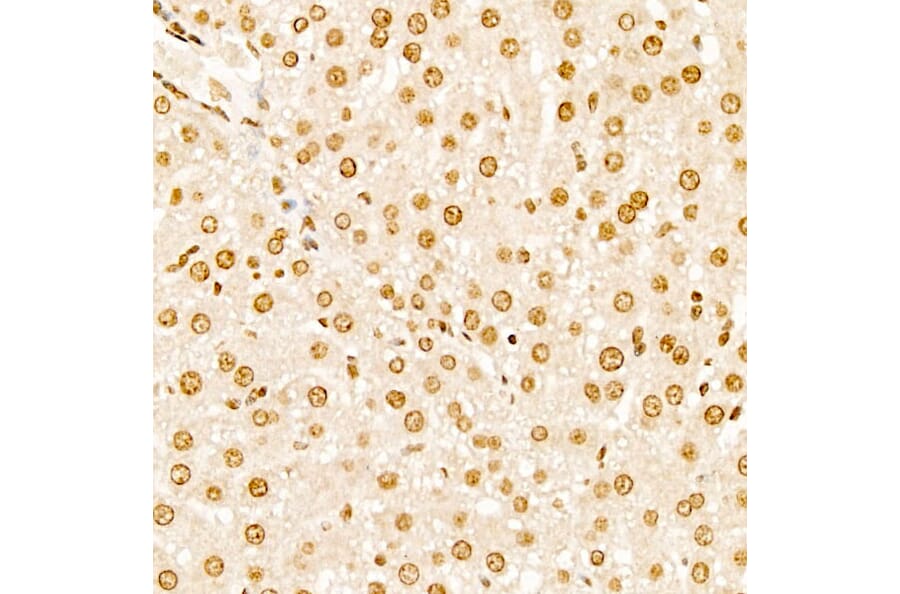 Immunohistochemistry - Anti-TAP Antibody (A329835) - Antibodies.com