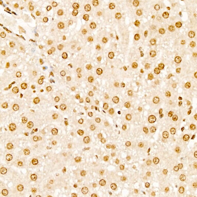 Immunohistochemistry - Anti-TAP Antibody (A329835) - Antibodies.com