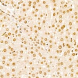 Immunohistochemistry - Anti-TAP Antibody (A329835) - Antibodies.com