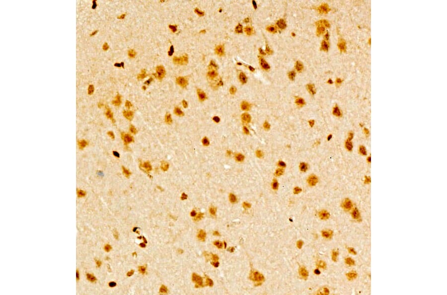 Immunohistochemistry - Anti-TAP Antibody (A329835) - Antibodies.com
