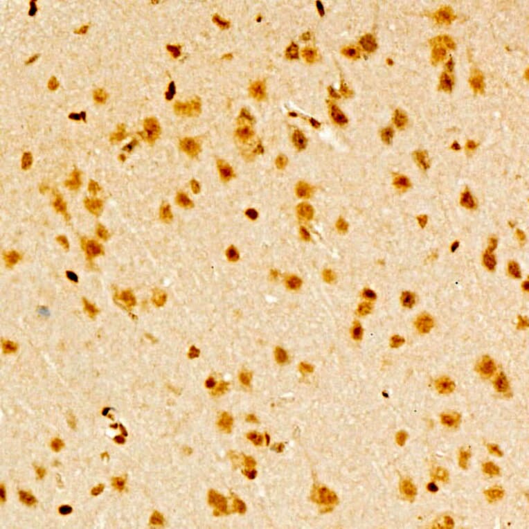 Immunohistochemistry - Anti-TAP Antibody (A329835) - Antibodies.com
