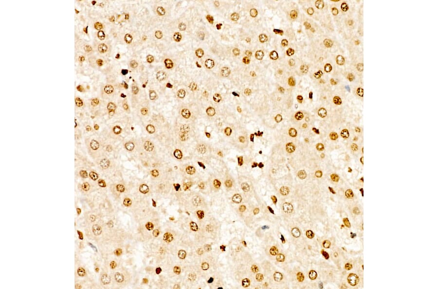 Immunohistochemistry - Anti-TAP Antibody (A329835) - Antibodies.com