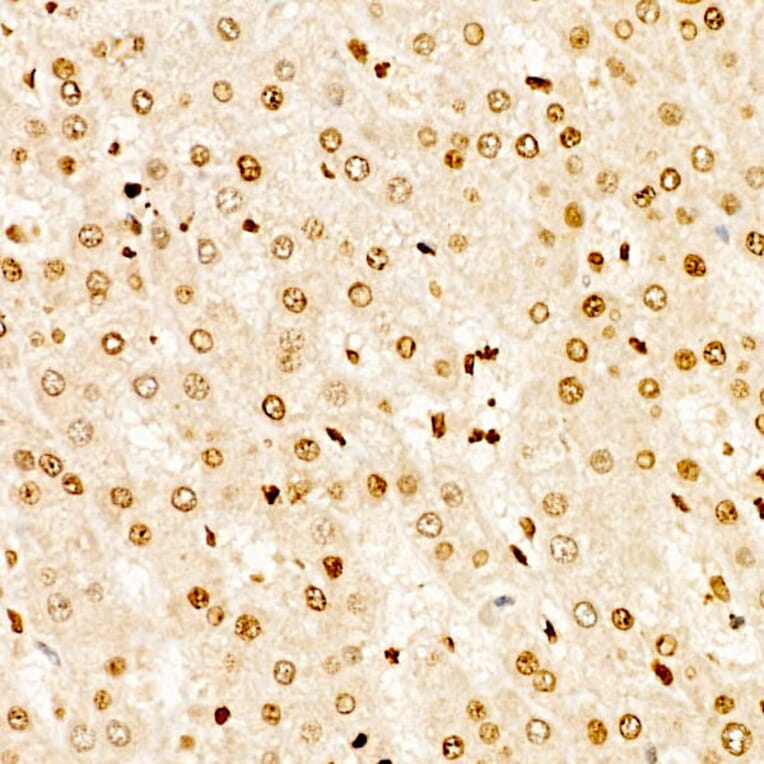 Immunohistochemistry - Anti-TAP Antibody (A329835) - Antibodies.com
