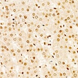 Immunohistochemistry - Anti-TAP Antibody (A329835) - Antibodies.com