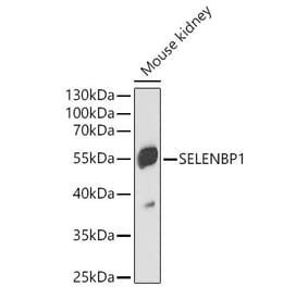 Western Blot - Anti-Selenium Binding Protein 1 Antibody (A329836) - Antibodies.com