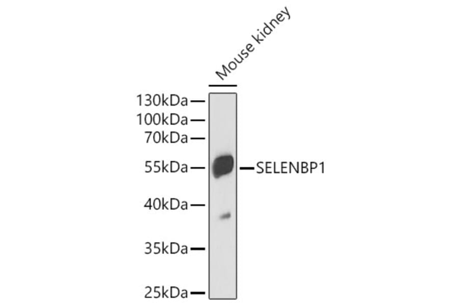 Western Blot - Anti-Selenium Binding Protein 1 Antibody (A329836) - Antibodies.com