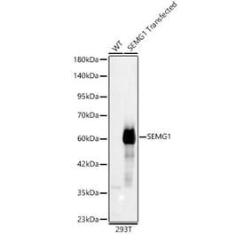 Western Blot - Anti-Semenogelin I Antibody (A329837) - Antibodies.com