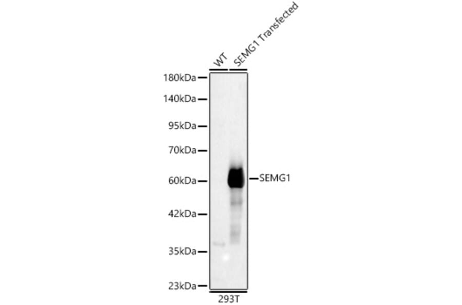 Western Blot - Anti-Semenogelin I Antibody (A329837) - Antibodies.com