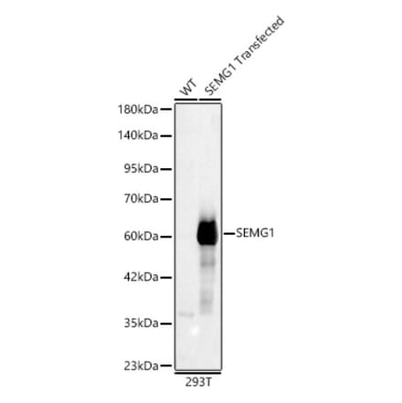 Western Blot - Anti-Semenogelin I Antibody (A329837) - Antibodies.com