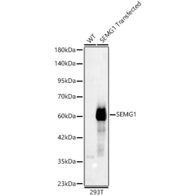 Western Blot - Anti-Semenogelin I Antibody (A329837) - Antibodies.com