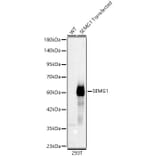 Western Blot - Anti-Semenogelin I Antibody (A329837) - Antibodies.com