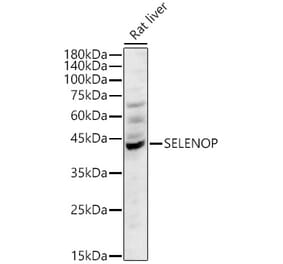 Western Blot - Anti-SEPP1 Antibody (A329838) - Antibodies.com