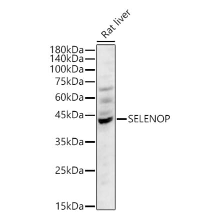 Western Blot - Anti-SEPP1 Antibody (A329838) - Antibodies.com