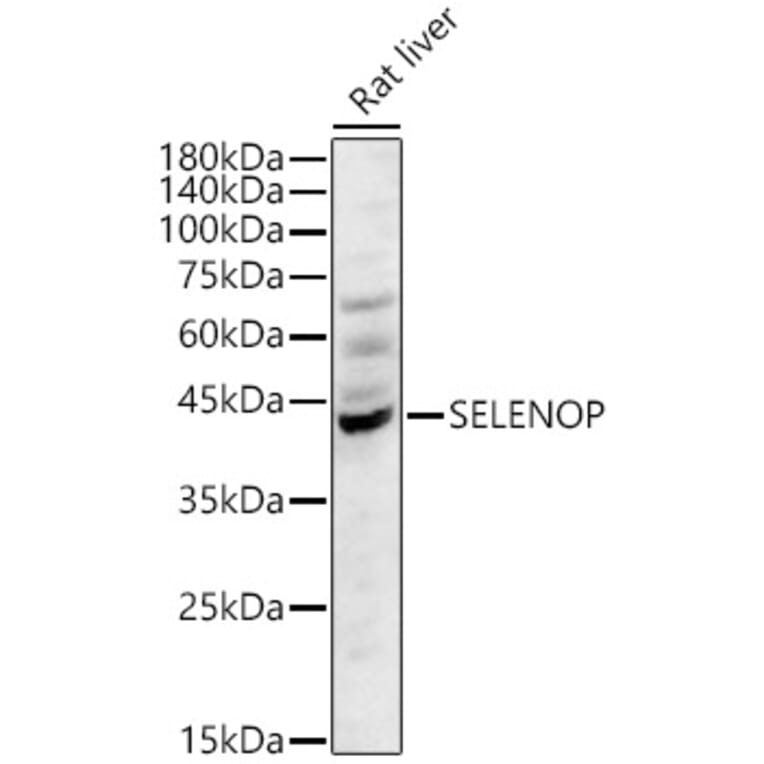Western Blot - Anti-SEPP1 Antibody (A329838) - Antibodies.com