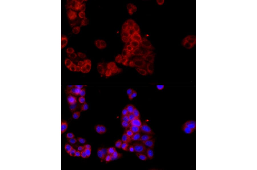Immunofluorescence - Anti-SEPP1 Antibody (A329838) - Antibodies.com