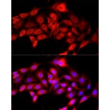 Immunofluorescence - Anti-SEPP1 Antibody (A329838) - Antibodies.com